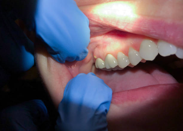 Best Emergency Dental Care for Trauma or Injury in Moonachie, NJ