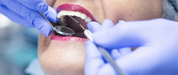 Best Emergency Wisdom Teeth Removal in Moonachie, NJ